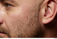  HD Face Skin Neeo bearded ear face skin pores skin texture wrinkles 0001.jpg